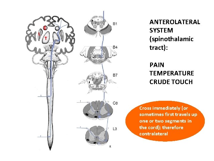 ANTEROLATERAL SYSTEM (spinothalamic tract): PAIN TEMPERATURE CRUDE TOUCH Cross immediately (or sometimes first travels