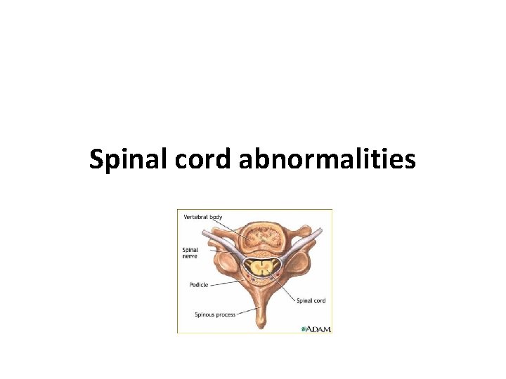 Spinal cord abnormalities 