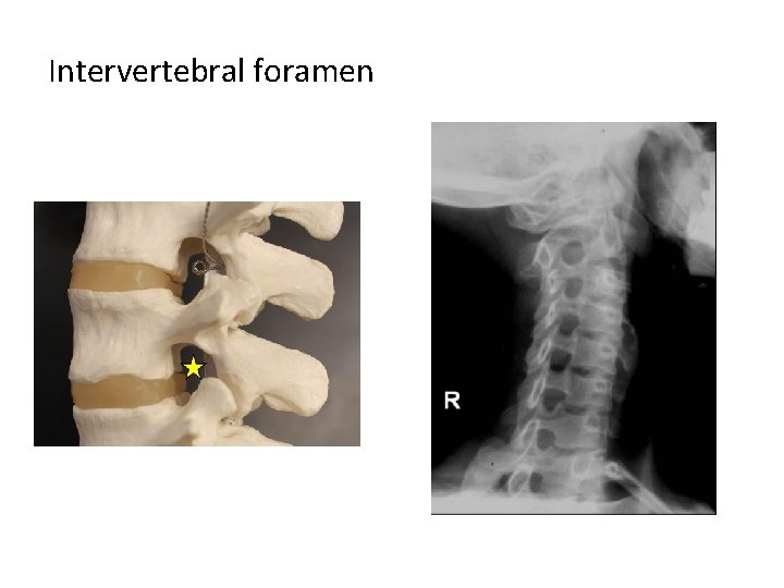 Intervertebral foramen 
