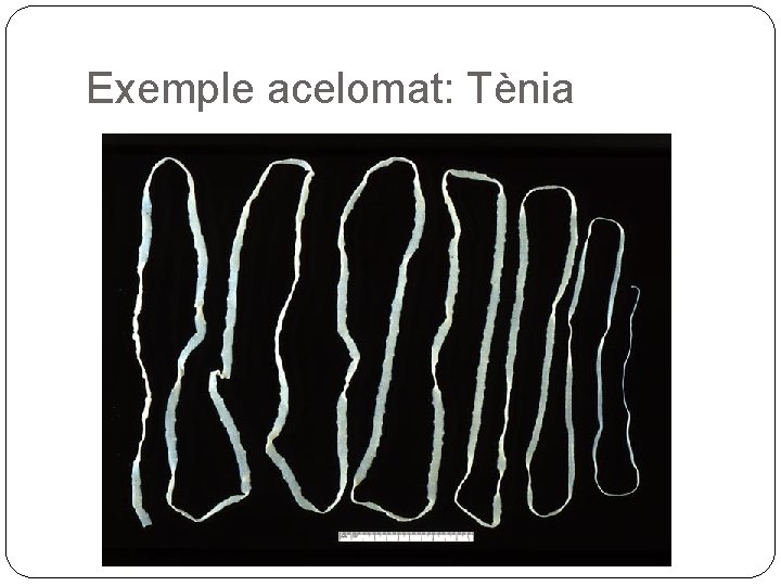 Exemple acelomat: Tènia 