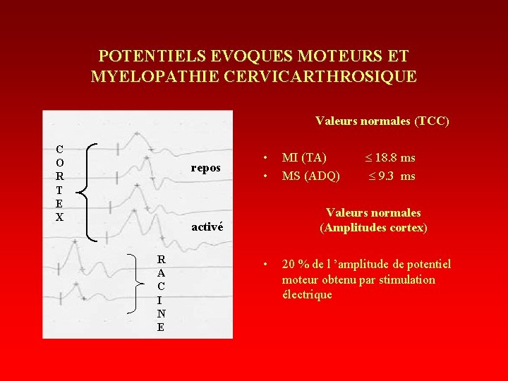 POTENTIELS EVOQUES MOTEURS ET MYELOPATHIE CERVICARTHROSIQUE Valeurs normales (TCC) C O R T E