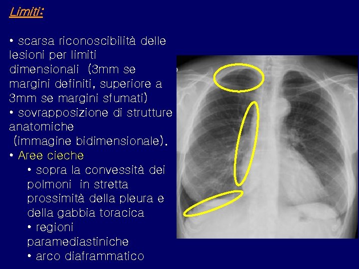 Limiti: • scarsa riconoscibilità delle lesioni per limiti dimensionali (3 mm se margini definiti,