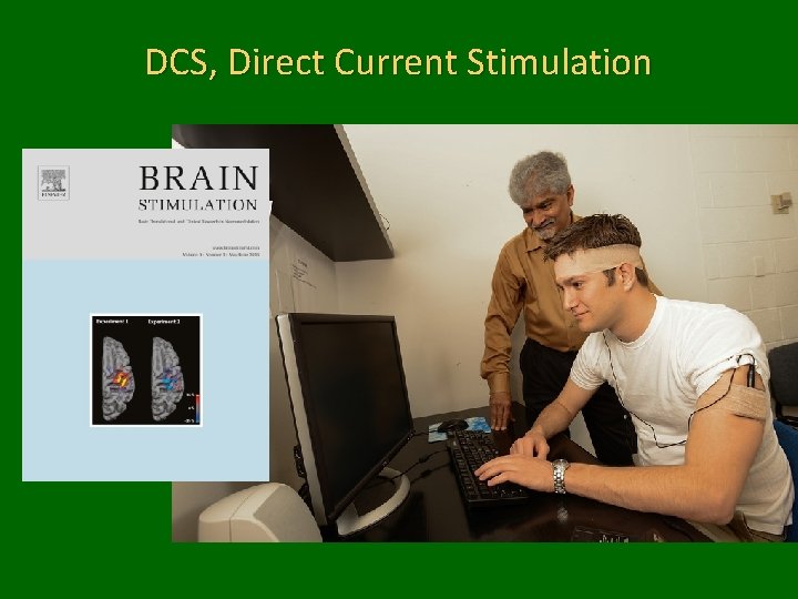DCS, Direct Current Stimulation 