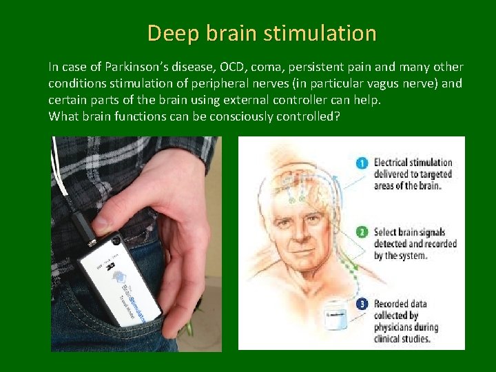 Deep brain stimulation In case of Parkinson’s disease, OCD, coma, persistent pain and many
