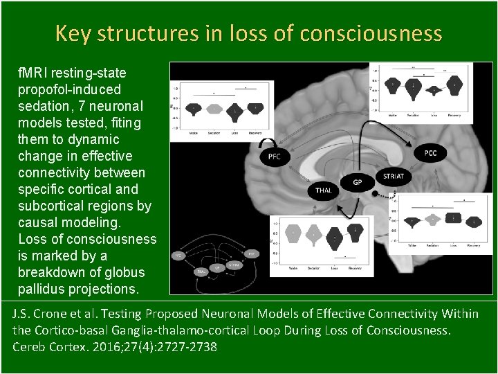 Key structures in loss of consciousness f. MRI resting-state propofol-induced sedation, 7 neuronal models