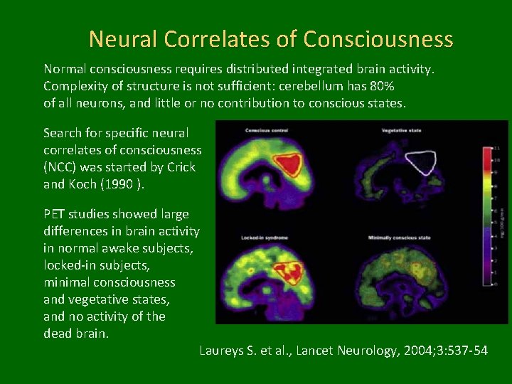 Neural Correlates of Consciousness Normal consciousness requires distributed integrated brain activity. Complexity of structure