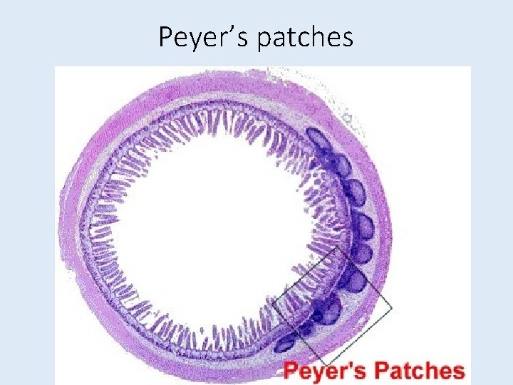 Peyer’s patches 