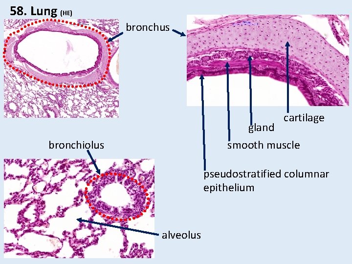 58. Lung (HE) bronchus cartilage gland smooth muscle bronchiolus pseudostratified columnar epithelium alveolus 