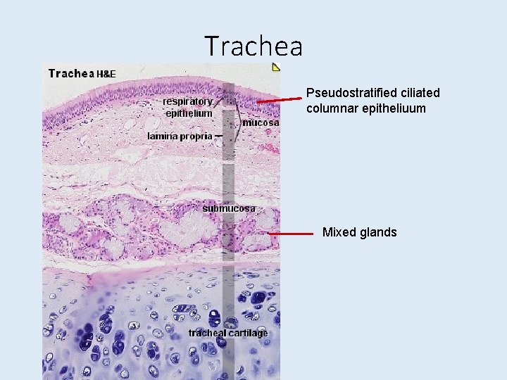 Trachea Pseudostratified ciliated columnar epitheliuum Mixed glands 