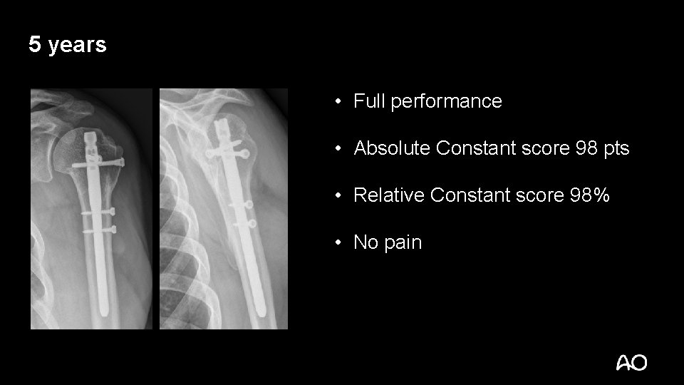 5 years • Full performance • Absolute Constant score 98 pts • Relative Constant