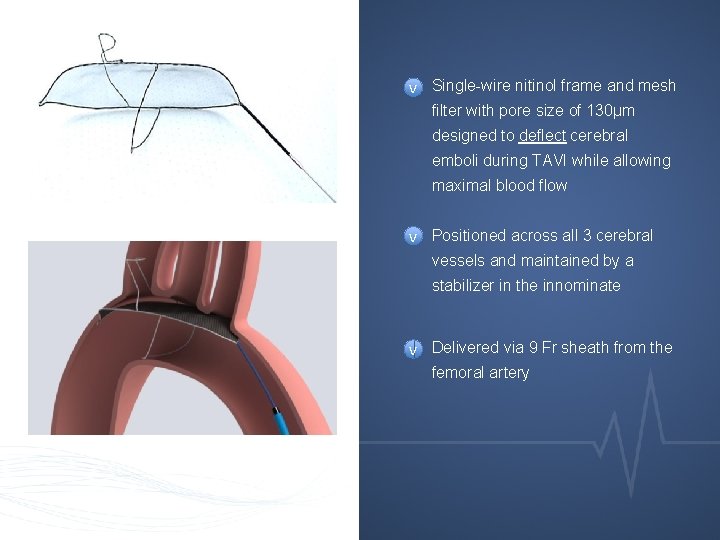 v Single-wire nitinol frame and mesh filter with pore size of 130μm designed to