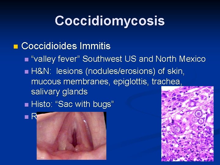 Coccidiomycosis n Coccidioides Immitis “valley fever” Southwest US and North Mexico n H&N: lesions