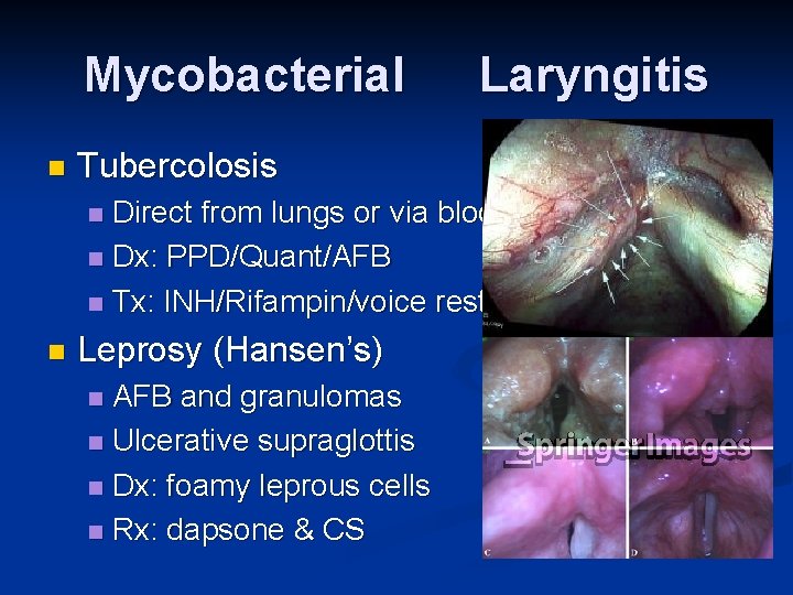 Mycobacterial n Laryngitis Tubercolosis Direct from lungs or via blood n Dx: PPD/Quant/AFB n