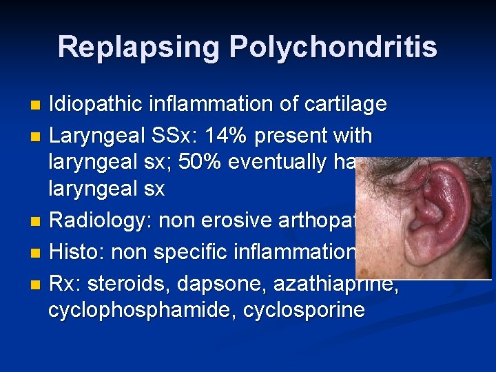 Replapsing Polychondritis Idiopathic inflammation of cartilage n Laryngeal SSx: 14% present with laryngeal sx;
