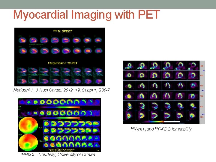 Myocardial Imaging with PET Maddahi J. , J Nucl Cardiol 2012; 19, Suppl 1,