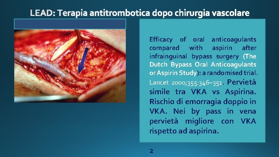 Efficacy of oral anticoagulants compared with aspirin after infrainguinal bypass surgery (The Dutch Bypass