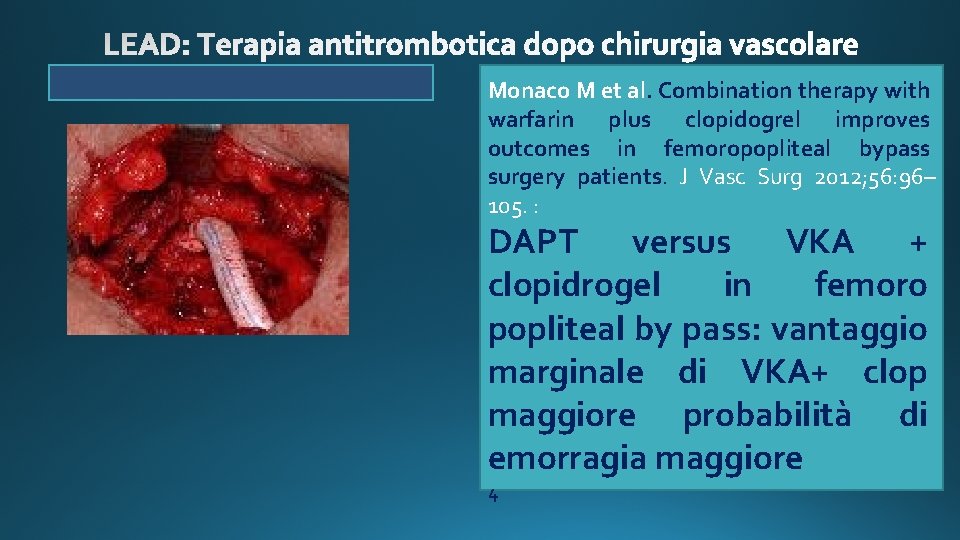 Monaco M et al. Combination therapy with warfarin plus clopidogrel improves outcomes in femoropopliteal