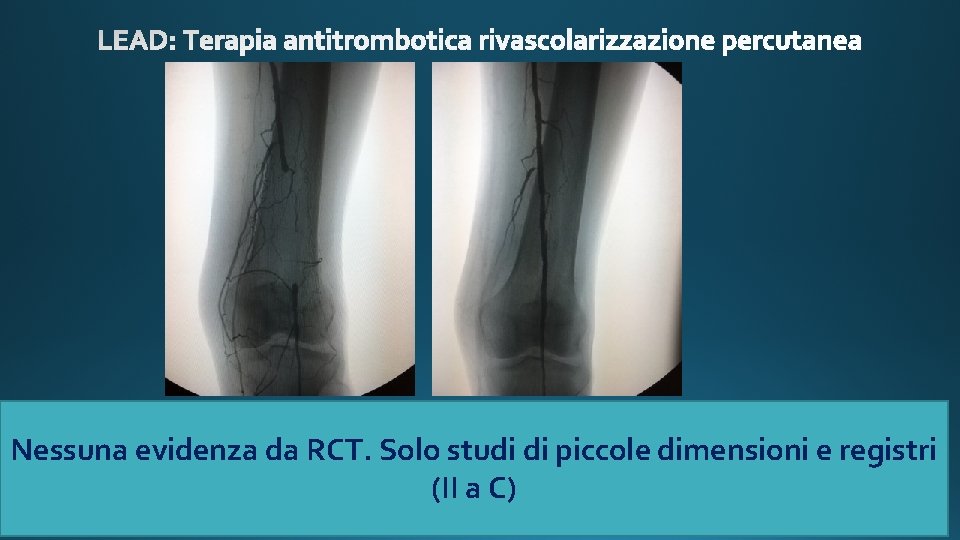 Nessuna evidenza da RCT. Solo studi di piccole dimensioni e registri (II a C)