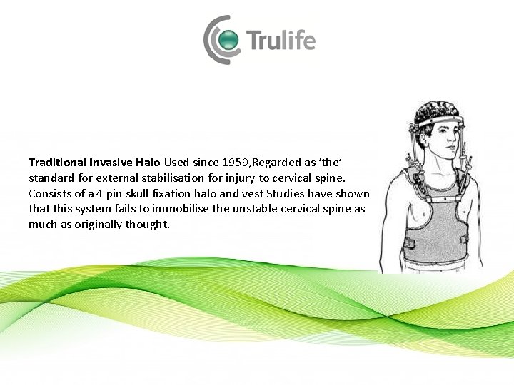 Traditional Invasive Halo Used since 1959, Regarded as ‘the’ standard for external stabilisation for