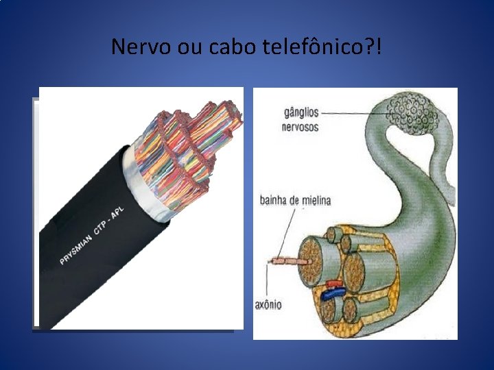Nervo ou cabo telefônico? ! Nervo ou cabo telefônico? !