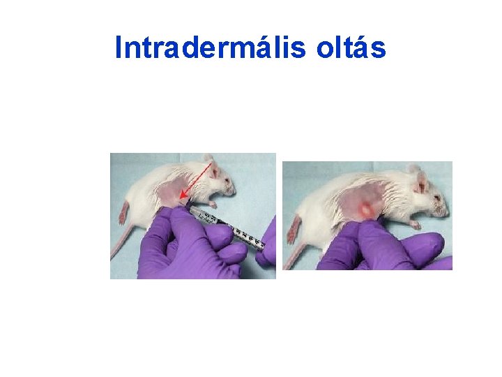 Intradermális oltás Intradermális oltás