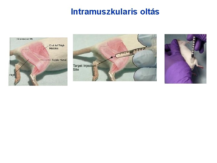 Intramuszkularis oltás Intramuszkularis oltás