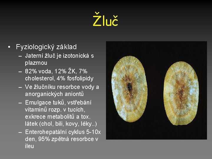 Žluč • Fyziologický základ – Jaterní žluč je izotonická s plazmou – 82% voda,