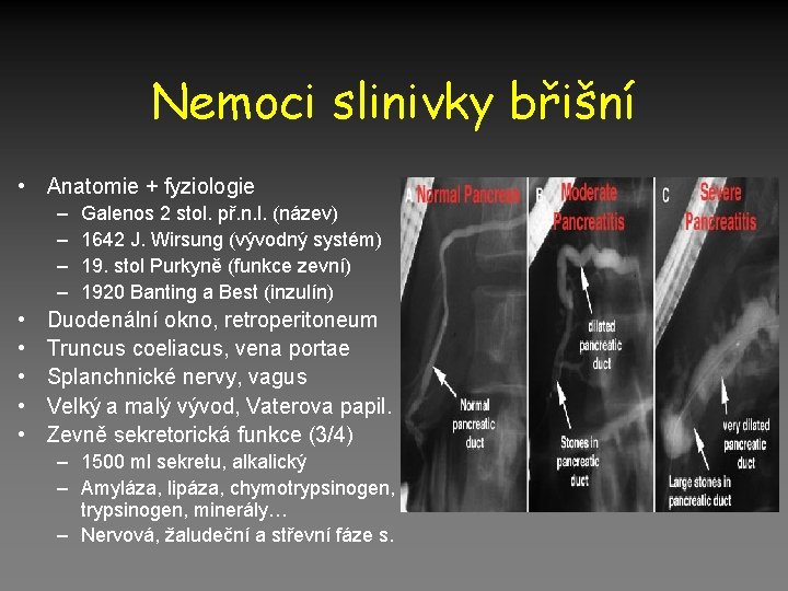 Nemoci slinivky břišní • Anatomie + fyziologie – – • • • Galenos 2