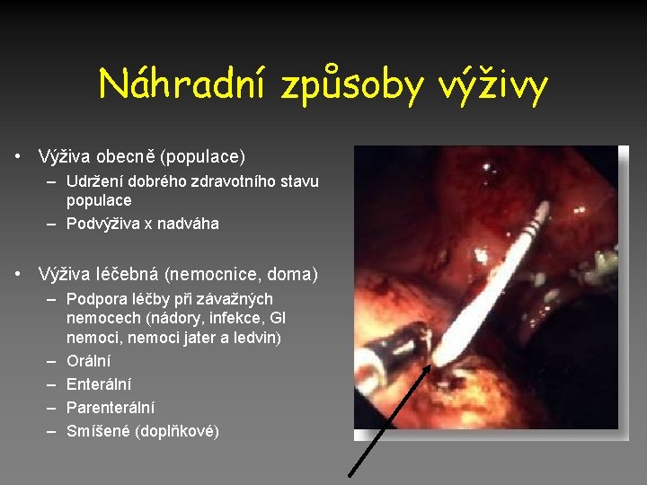 Náhradní způsoby výživy • Výživa obecně (populace) – Udržení dobrého zdravotního stavu populace –