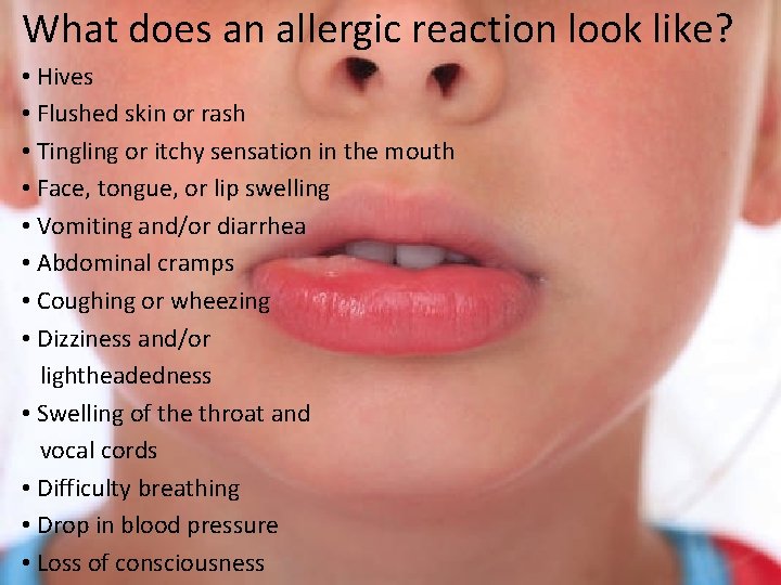 What does an allergic reaction look like? • Hives • Flushed skin or rash