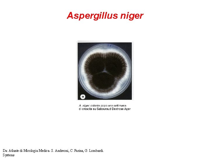 Aspergillus niger Da: Atlante di Micologia Medica- S. Andreoni, C. Farina, G. Lombardi. Systems