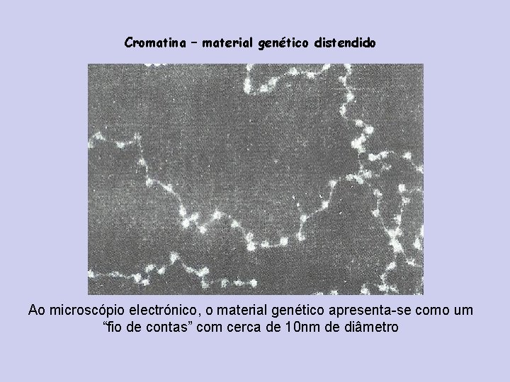 Cromatina – material genético distendido Ao microscópio electrónico, o material genético apresenta-se como um