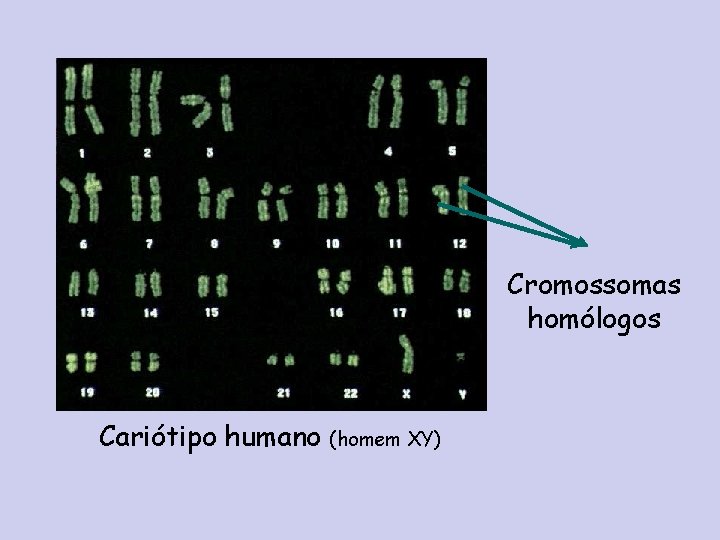 Cromossomas homólogos Cariótipo humano (homem XY) 