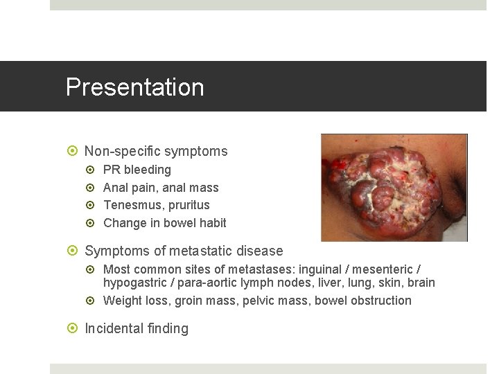 Presentation Non-specific symptoms PR bleeding Anal pain, anal mass Tenesmus, pruritus Change in bowel