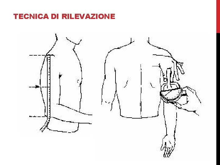 TECNICA DI RILEVAZIONE 