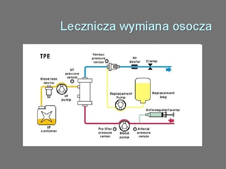 Lecznicza wymiana osocza 