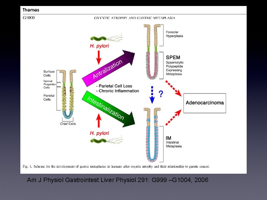 Am J Physiol Gastrointest Liver Physiol 291: G 999 –G 1004, 2006 