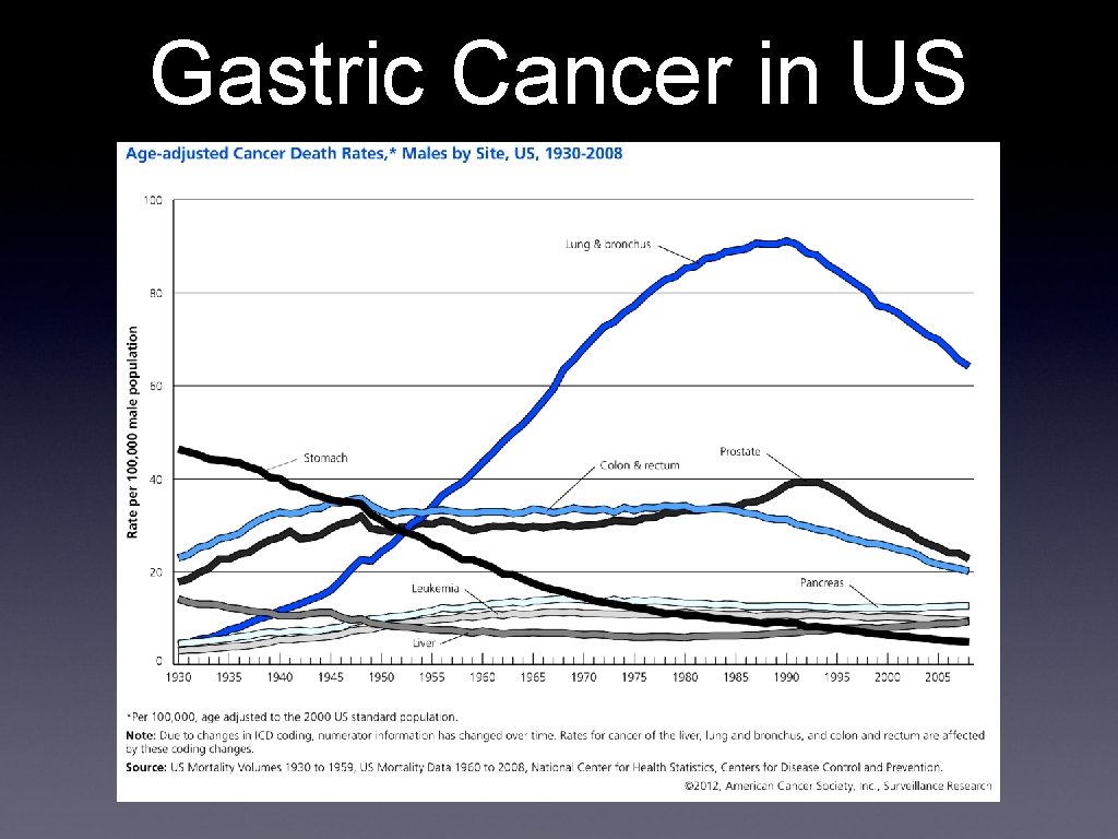 Gastric Cancer in US 