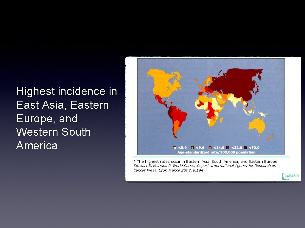 Highest incidence in East Asia, Eastern Europe, and Western South America 