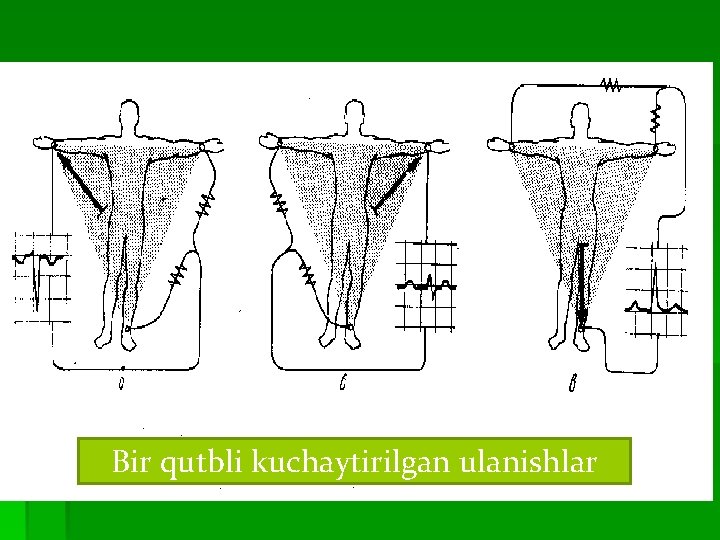 Bir qutbli kuchaytirilgan ulanishlar 