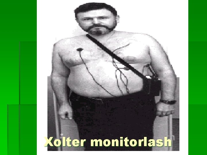 Xolter monitorlash 