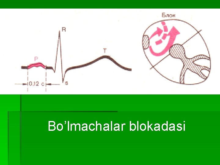 Bo’lmachalar blokadasi 