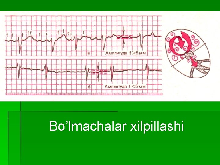 Bo’lmachalar xilpillashi 