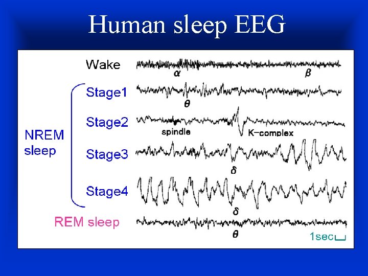 Human sleep EEG 