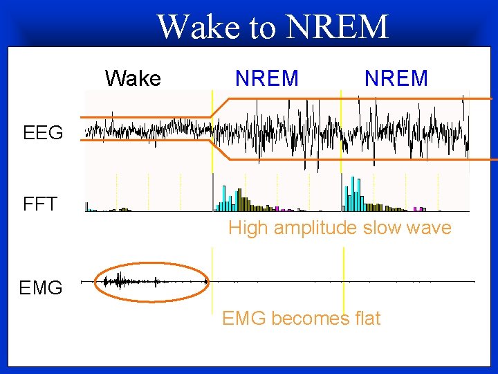 Wake to NREM Wake NREM EEG FFT High amplitude slow wave EMG becomes flat