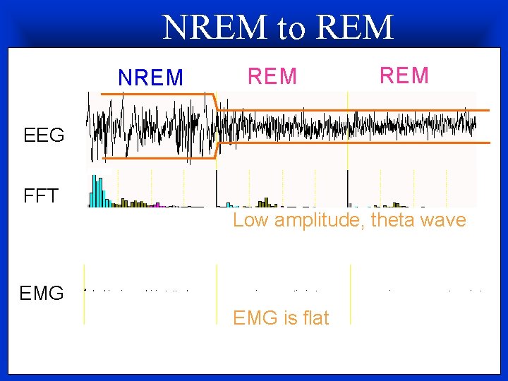 NREM to REM NREM REM EEG FFT Low amplitude, theta wave EMG is flat