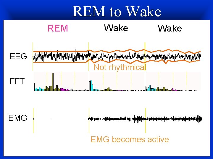 REM to Wake REM Wake EEG Not rhythmical FFT EMG becomes active 