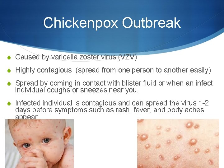 Chickenpox Outbreak S Caused by varicella zoster virus (VZV) S Highly contagious (spread from