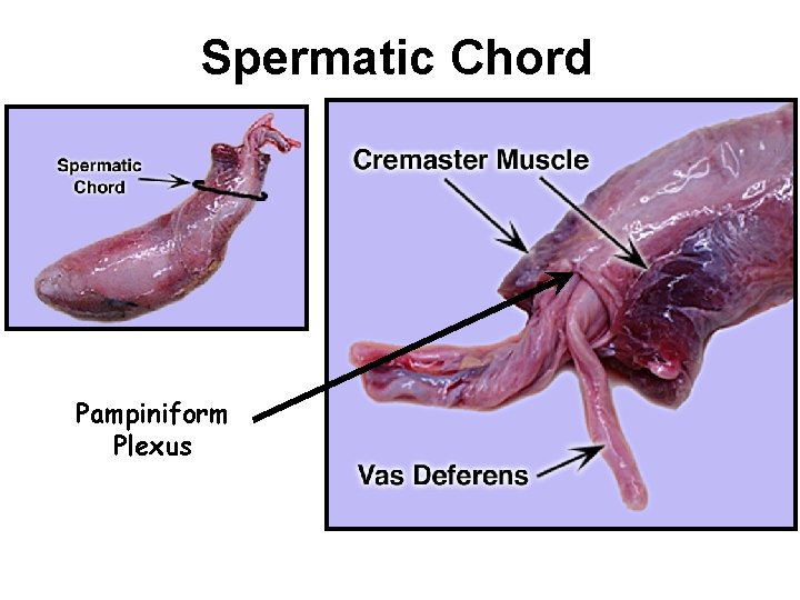 Spermatic Chord Pampiniform Plexus 