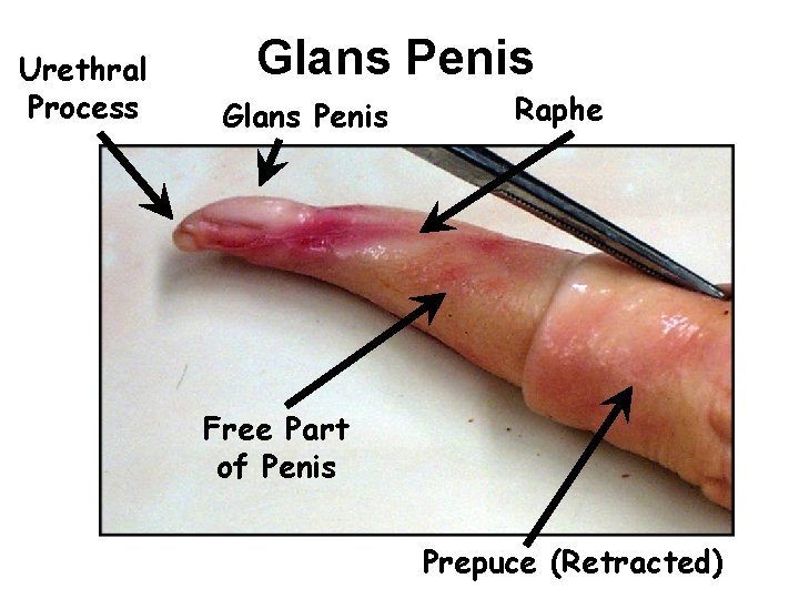 Urethral Process Glans Penis Raphe Free Part of Penis Prepuce (Retracted) 